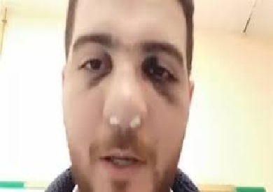 طبيب المنوفية